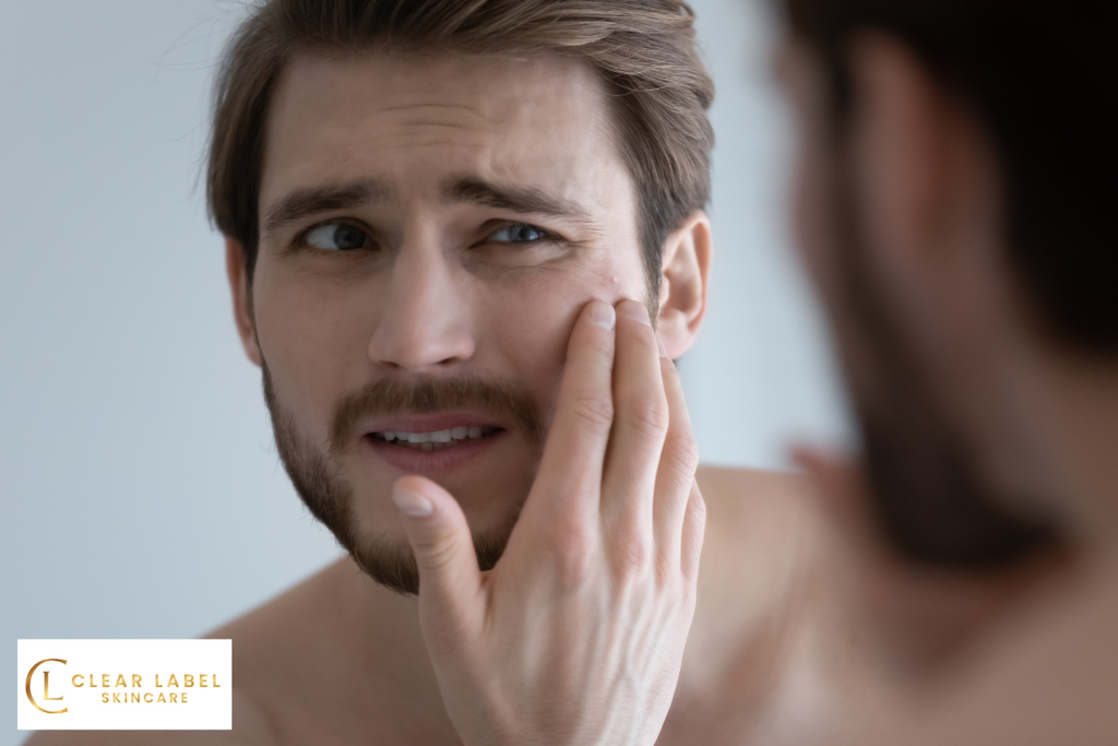 Gentle Skincare Products for Sensitive Skin